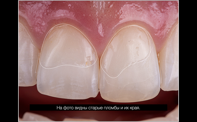 Фото до процедуры 40